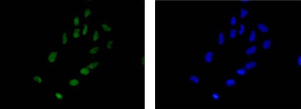 Immunocytochemistry/ Immunofluorescence - Anti-Alpha B Crystallin antibody [EPR2752] - BSA and Azide free (AB247476)