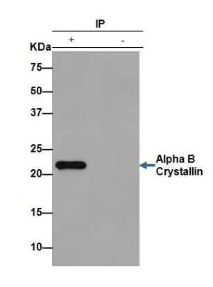 Immunoprecipitation - Anti-Alpha B Crystallin antibody [EPR2752] - BSA and Azide free (AB247476)