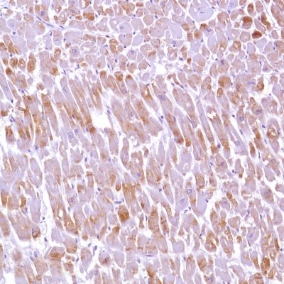 Immunohistochemistry (Formalin/PFA-fixed paraffin-embedded sections) - Anti-Alpha B Crystallin antibody [SP288] (ab226839), expandable thumbnail