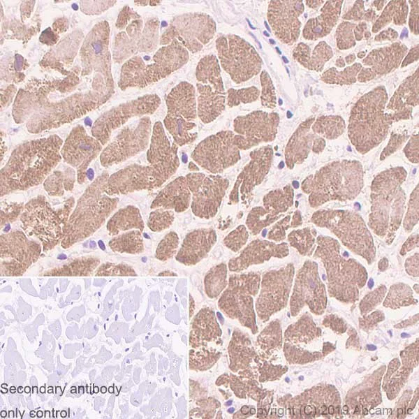 Immunohistochemistry (Formalin/PFA-fixed paraffin-embedded sections) - Anti-Alpha B Crystallin antibody [SP288] (AB226839)
