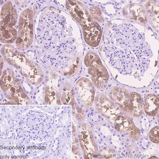 Immunohistochemistry (Formalin/PFA-fixed paraffin-embedded sections) - Anti-Alpha B Crystallin antibody [SP288] (AB226839)