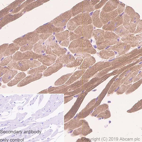 Immunohistochemistry (Formalin/PFA-fixed paraffin-embedded sections) - Anti-Alpha B Crystallin antibody [SP288] (AB226839)