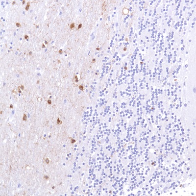 Immunohistochemistry (Formalin/PFA-fixed paraffin-embedded sections) - Anti-Alpha B Crystallin antibody [SP288] (AB226839), expandable thumbnail