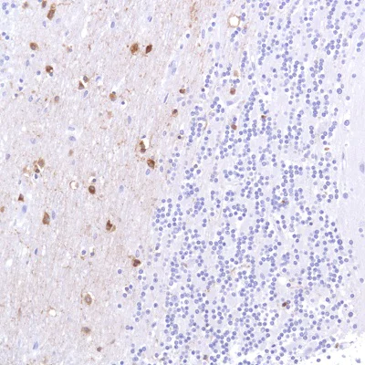 Immunohistochemistry (Formalin/PFA-fixed paraffin-embedded sections) - Anti-Alpha B Crystallin antibody [SP288] (AB226839)