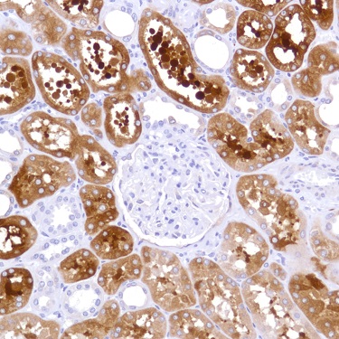 Immunohistochemistry (Formalin/PFA-fixed paraffin-embedded sections) - Anti-Alpha B Crystallin antibody [SP288] (AB226839), expandable thumbnail