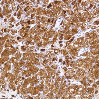 Immunohistochemistry (Formalin/PFA-fixed paraffin-embedded sections) - Anti-Alpha B Crystallin antibody [SP288] - BSA and Azide free (AB272007)
