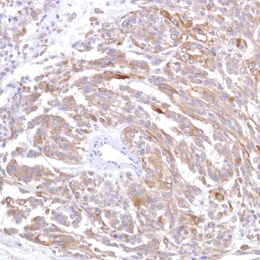 Immunohistochemistry (Formalin/PFA-fixed paraffin-embedded sections) - Anti-Alpha B Crystallin antibody [SP288] - BSA and Azide free (AB272007)
