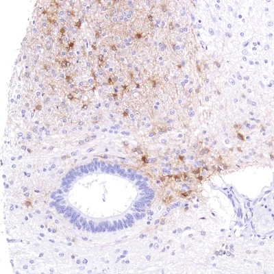Immunohistochemistry (Formalin/PFA-fixed paraffin-embedded sections) - Anti-Alpha B Crystallin antibody [SP288] - BSA and Azide free (AB272007)