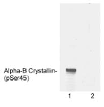 Western blot - Anti-Alpha B Crystallin (phospho S45) antibody (AB5598), expandable thumbnail