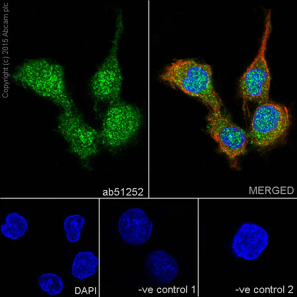 Immunocytochemistry/ Immunofluorescence - Anti-alpha + beta Synuclein antibody [EP1646Y] (AB51252)