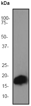 Western blot - Anti-alpha + beta Synuclein antibody [EP1646Y] (AB51252)