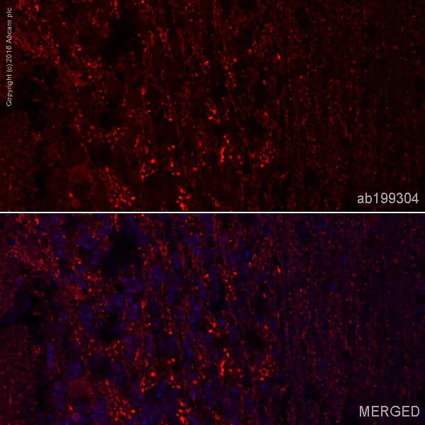 Immunohistochemistry (Formalin/PFA-fixed paraffin-embedded sections) - Anti-alpha + beta Synuclein antibody [EP1646Y] - BSA and Azide free (AB189217)