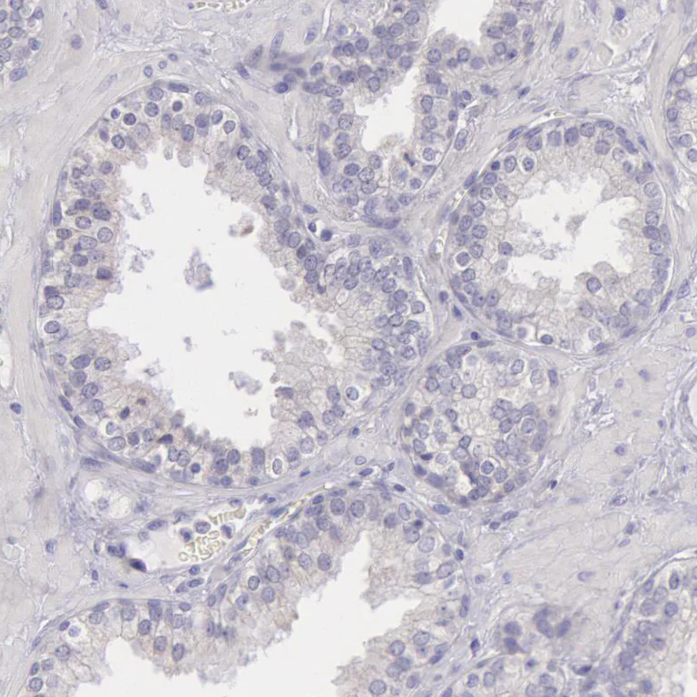 Immunohistochemistry (Formalin/PFA-fixed paraffin-embedded sections) - Anti-alpha-cardiac myosin heavy chain antibody (AB224046)