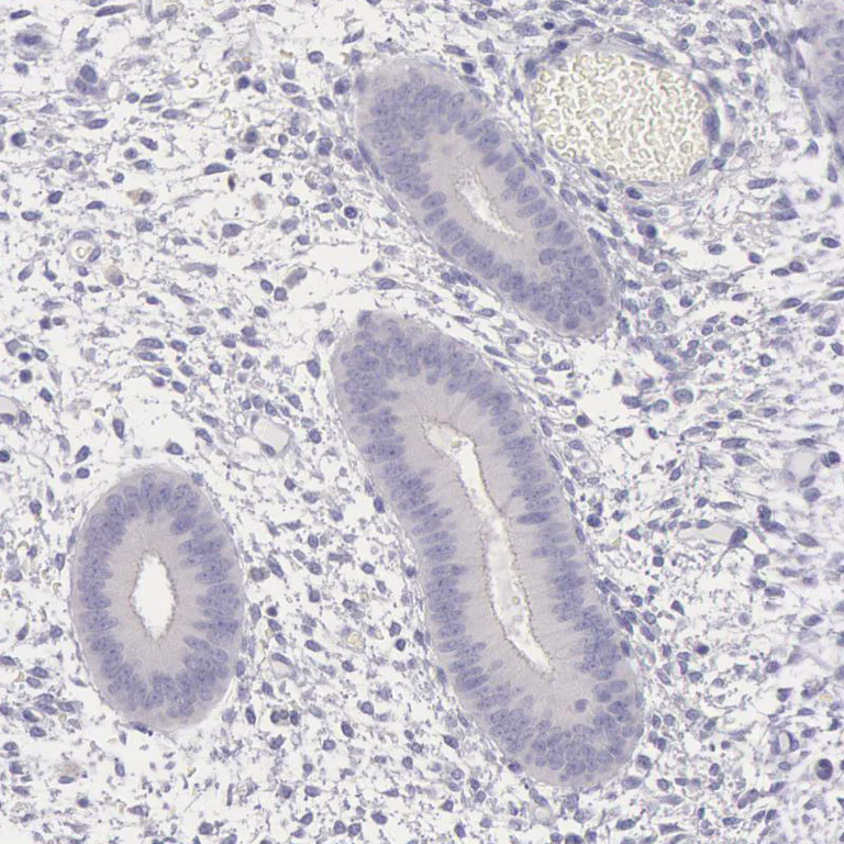 Immunohistochemistry (Formalin/PFA-fixed paraffin-embedded sections) - Anti-alpha-cardiac myosin heavy chain antibody (AB224046)