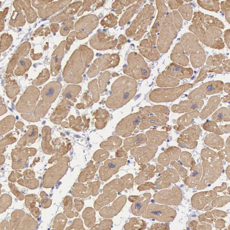 Immunohistochemistry (Formalin/PFA-fixed paraffin-embedded sections) - Anti-alpha-cardiac myosin heavy chain antibody (AB224046)