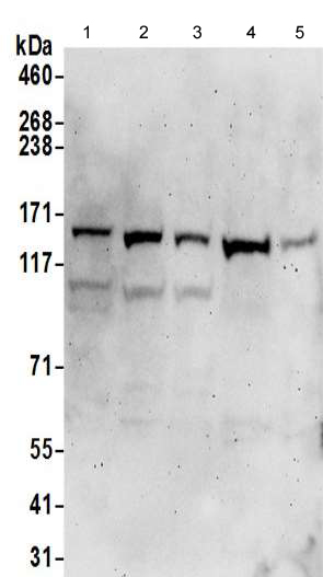 Western blot - Anti-alpha COP I/COPA antibody - C-terminal (AB192919)