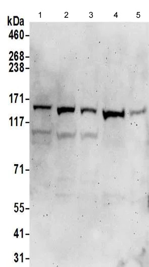 Western blot - Anti-alpha COP I/COPA antibody - C-terminal (AB192919)