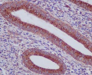 Immunohistochemistry (Formalin/PFA-fixed paraffin-embedded sections) - Anti-alpha COP I/COPA antibody [EPR14273(B)] - BSA and Azide free (AB250440), expandable thumbnail