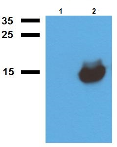 Western blot - Anti-Alpha-crystallin hspX antibody (AB231177), expandable thumbnail