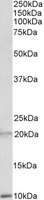 Western blot - Anti-alpha Defensin 1 + 2 + 3 antibody (AB99504)