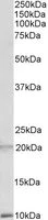 Western blot - Anti-alpha Defensin 1 + 2 + 3 antibody (AB99504)