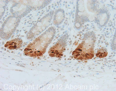 Immunohistochemistry (Formalin/PFA-fixed paraffin-embedded sections) - Anti-alpha Defensin 5 antibody [8C8] (AB62757)
