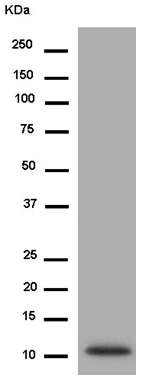 Western blot - Anti-alpha Defensin 5 antibody [EPR14309(B)] (AB180515), expandable thumbnail