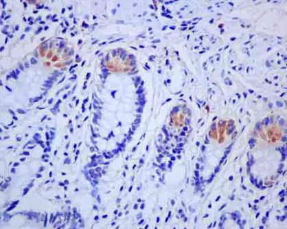 Immunohistochemistry (Formalin/PFA-fixed paraffin-embedded sections) - Anti-alpha Defensin 5 antibody [EPR14309(B)] - BSA and Azide free (AB245946)