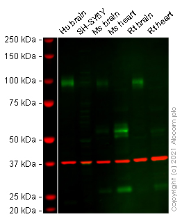 Western blot - Anti-Alpha Dystroglycan antibody [2238] (AB106110)