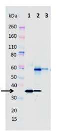 Western blot - Anti-alpha-hemolysin antibody [8B7] - N-terminal (AB190467), expandable thumbnail
