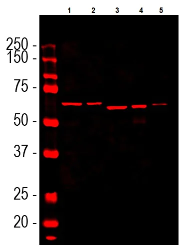 Western blot - Anti-alpha Internexin antibody [2E3] (AB7654)