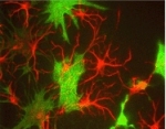 Immunocytochemistry/ Immunofluorescence - Anti-alpha Internexin antibody (AB7259), expandable thumbnail