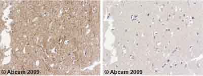Immunohistochemistry (Formalin/PFA-fixed paraffin-embedded sections) - Anti-alpha Internexin antibody (AB7259), expandable thumbnail