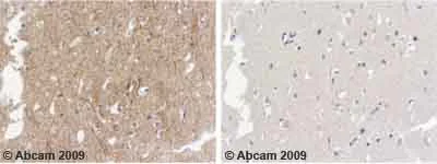 Immunohistochemistry (Formalin/PFA-fixed paraffin-embedded sections) - Anti-alpha Internexin antibody (AB7259)