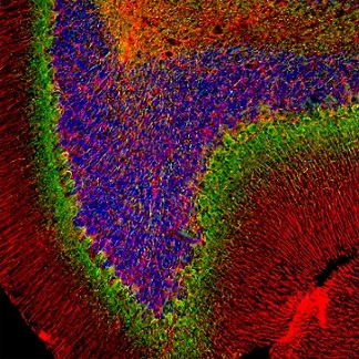 Immunohistochemistry (PFA perfusion fixed frozen sections) - Anti-alpha Internexin antibody (AB7259), expandable thumbnail