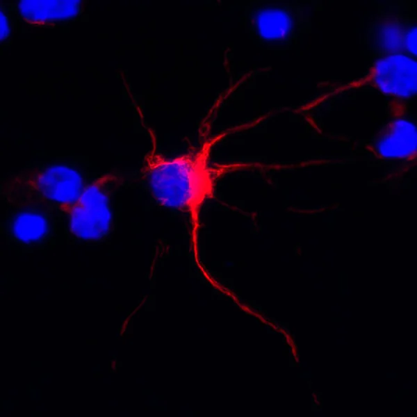 Immunocytochemistry/ Immunofluorescence - Anti-alpha Internexin antibody [EP676Y] (AB40758)