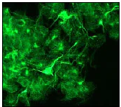 Immunocytochemistry/ Immunofluorescence - Anti-alpha Internexin antibody [EP676Y] (AB40758)