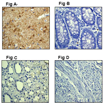 Immunohistochemistry (Formalin/PFA-fixed paraffin-embedded sections) - Anti-alpha Internexin antibody [EP676Y] (AB40758)