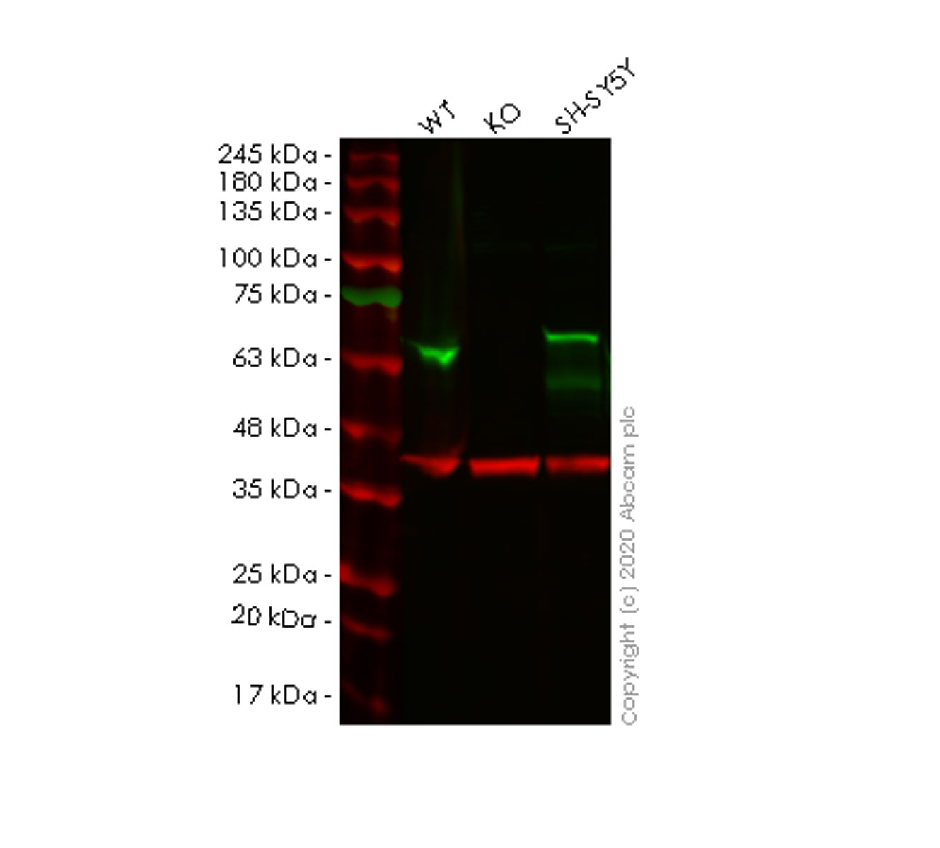 Western blot - Anti-alpha Internexin antibody [EP676Y] (AB40758)