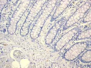Immunohistochemistry (Formalin/PFA-fixed paraffin-embedded sections) - Anti-alpha Internexin antibody [EPR1529] (AB108302)