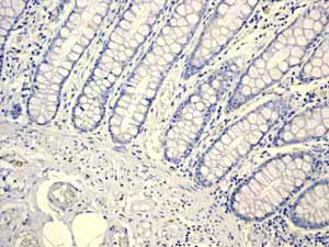 Immunohistochemistry (Formalin/PFA-fixed paraffin-embedded sections) - Anti-alpha Internexin antibody [EPR1529] (AB108302)