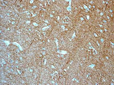 Anti-alpha Internexin antibody [EPR1529]