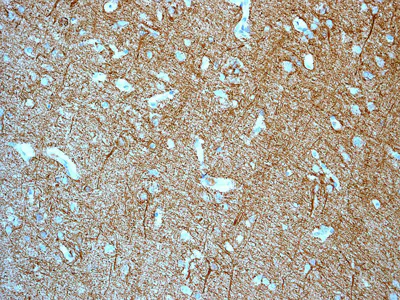 Immunohistochemistry (Formalin/PFA-fixed paraffin-embedded sections) - Anti-alpha Internexin antibody [EPR1529] - BSA and Azide free (AB247623)