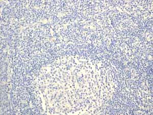 Immunohistochemistry (Formalin/PFA-fixed paraffin-embedded sections) - Anti-alpha Internexin antibody [EPR1529] - BSA and Azide free (AB247623)