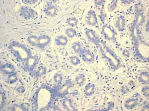 Immunohistochemistry (Formalin/PFA-fixed paraffin-embedded sections) - Anti-alpha Internexin antibody [EPR1529] - BSA and Azide free (AB247623)
