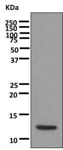 Western blot - Anti-alpha Lactalbumin antibody [EPR12460] (AB178431)