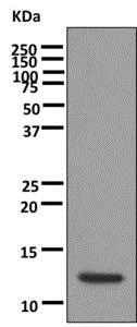 Western blot - Anti-alpha Lactalbumin antibody [EPR12460] (AB178431)