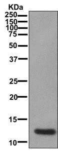 Western blot - Anti-alpha Lactalbumin antibody [EPR12461] (AB180180)