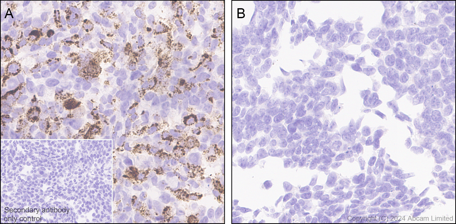 Immunohistochemistry (Formalin/PFA-fixed paraffin-embedded sections) - Anti-Alpha-S1-casein antibody [EPR29093-719] (AB323188), expandable thumbnail