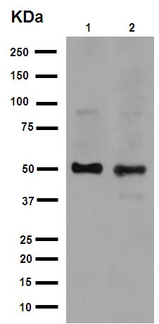 Western blot - Anti-alpha Sarcoglycan antibody [EPR14773] (AB189254)